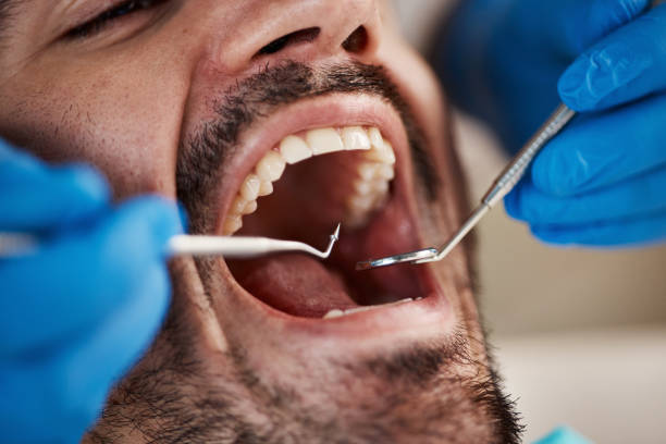 Best Emergency Dentist for Knocked-Out Tooth in Atglen, PA